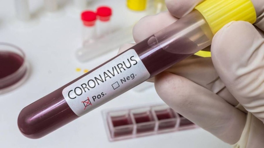 Enfermeira de Batayporã com covid-19 é transferida para Dourados