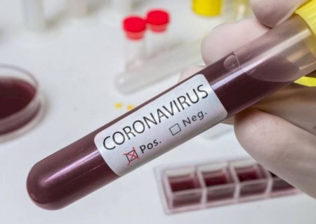 Enfermeira de Batayporã com covid-19 é transferida para Dourados