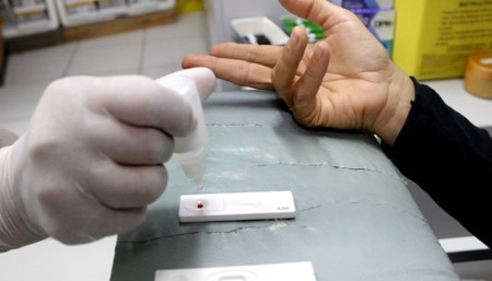 JULHO AMARELO: JÁ FEZ O TESTE DE HEPATITE? ENTÃO PROCURE AS UNIDADES DE SAÚDE DO MUNICÍPIO DE NOVO HORIZONTE DO SUL