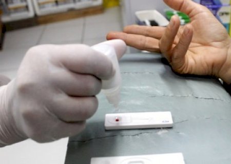 JULHO AMARELO: JÁ FEZ O TESTE DE HEPATITE? ENTÃO PROCURE AS UNIDADES DE SAÚDE DO MUNICÍPIO DE NOVO HORIZONTE DO SUL
