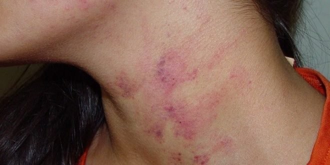 Filho consegue fugir e pedir ajuda a vizinho para mãe que era espancada por ex