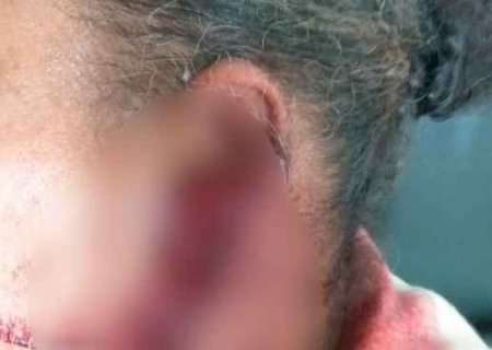 Mulher é agredida depois de flagrar esposa aos beijos com adolescente de 13 anos