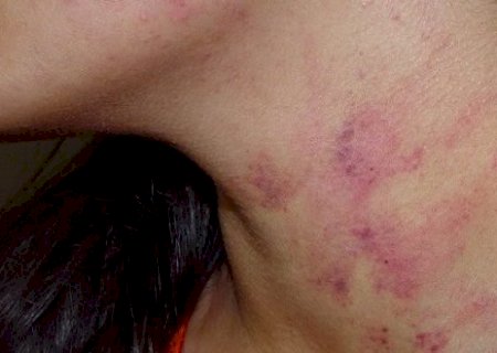Filho consegue fugir e pedir ajuda a vizinho para mãe que era espancada por ex