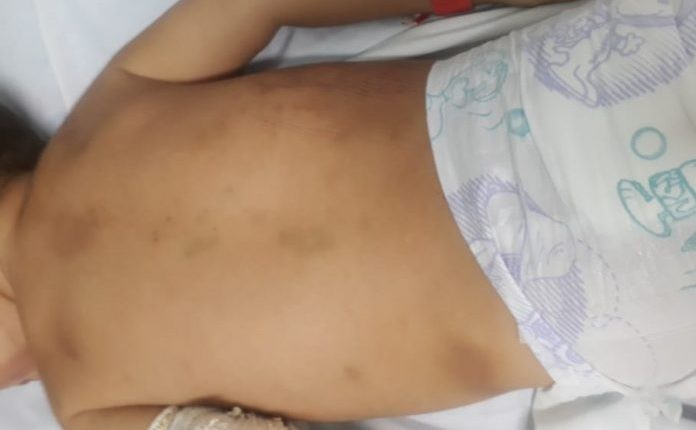 Bebê de 1 mês é internado em estado grave na Santa Casa e pais são investigados