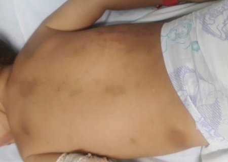 Bebê de 1 mês é internado em estado grave na Santa Casa e pais são investigados