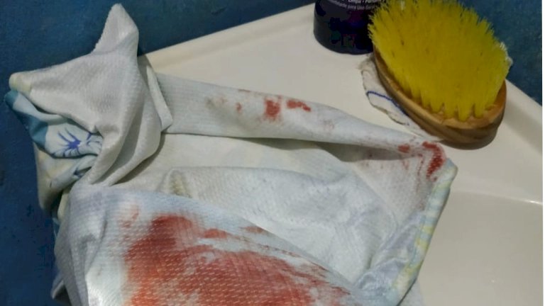 Deodapolis - Durante atendimento em posto de saúde, idosa conta que foi estuprada e homem acaba preso.