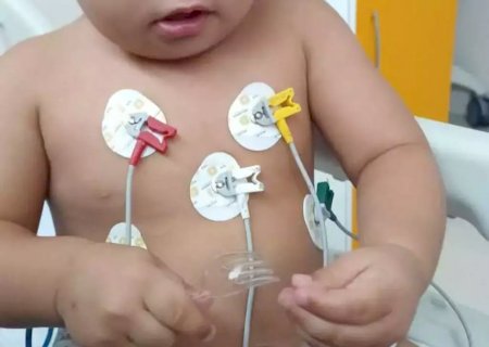 Bebê com fio metálico no coração passa por cirurgia que deve durar até 6 horas